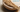 Komecera™: Exploring the Role of Rice Ceramides in Skin Health